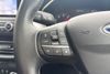 Ford Focus 1.5T EcoBoost Titanium X Euro 6 (s/s) 5dr