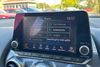 Nissan Juke 1.0 DiG-T 114 N-Connecta 5dr